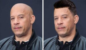 Imagine bald celebrities with full hair